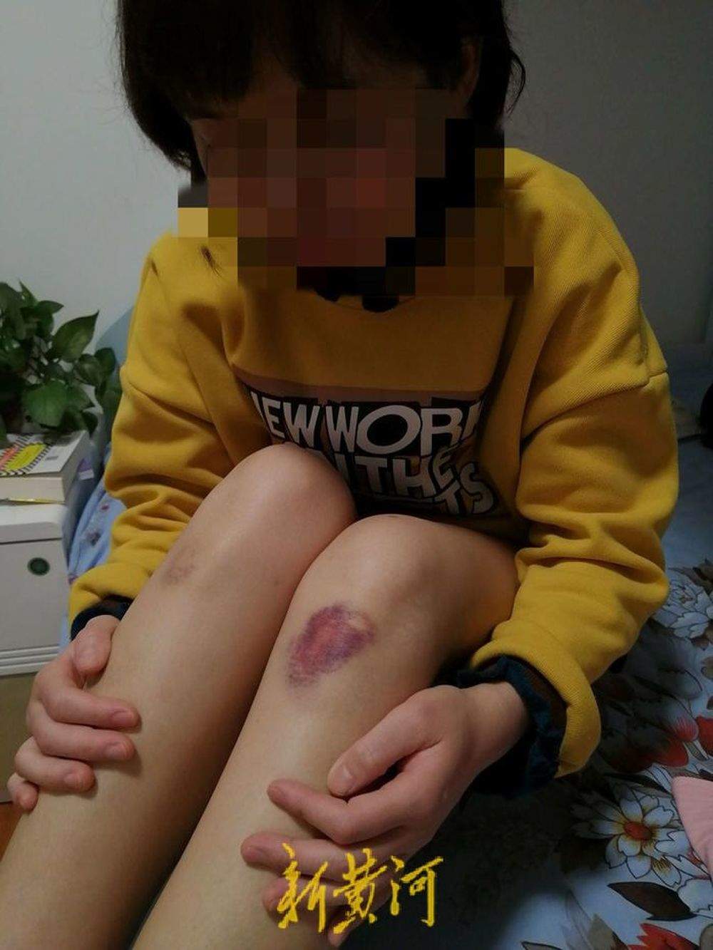 女子遭家暴致死案即将开庭，深度解读家庭暴力背后的悲剧阴影