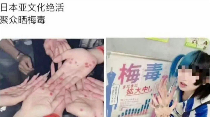 日本梅毒病例创新高，小城温馨故事仍继续前行