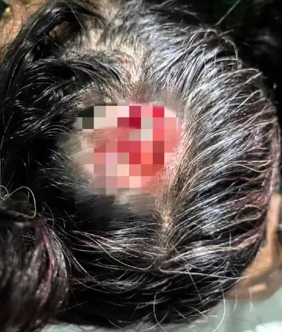 鲨鱼夹的冒险与爱的力量，女子意外成植物人后，陪伴与力量的体现