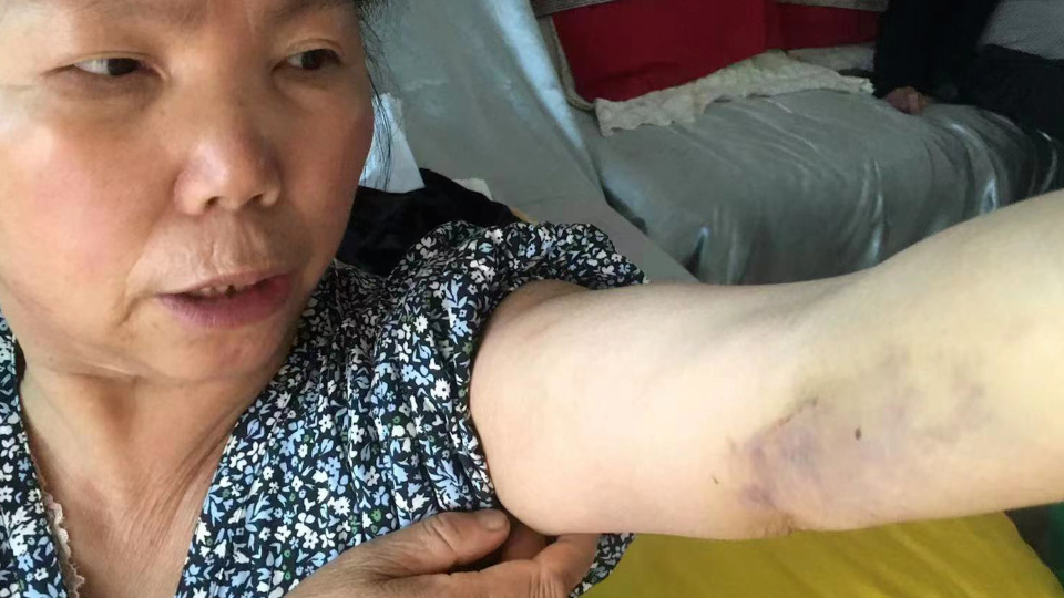 警方回应女子被误认赌徒遭打断肋骨事件，事件分析与反思