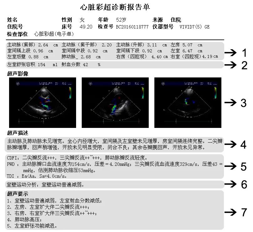 最新心脏彩超正常值及其论述详解